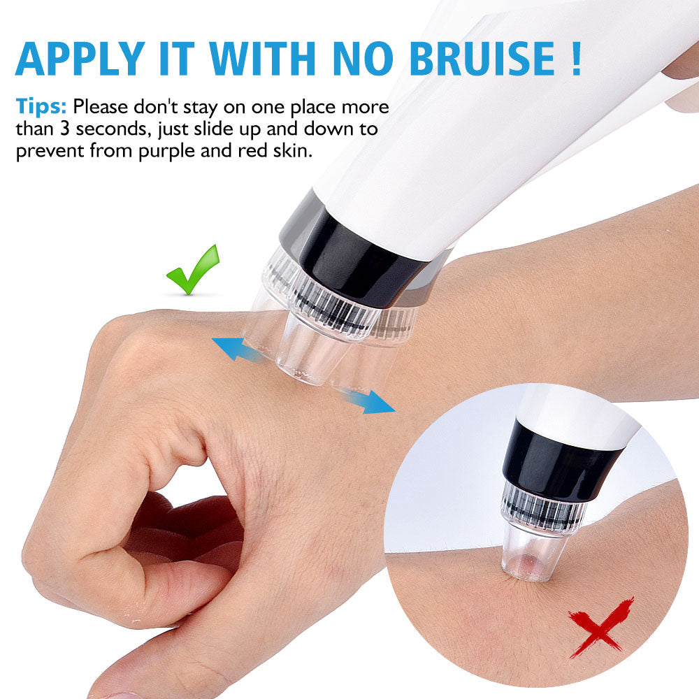 Blackhead Remover Vacuum Pore Cleaner
