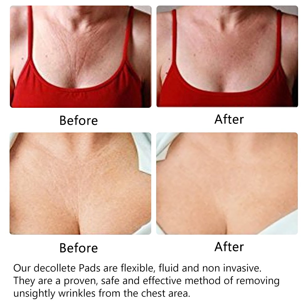 Anti-Wrinkle Neck Chest Silicone Pad