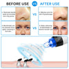 Image of Blackhead Remover Vacuum Pore Cleaner